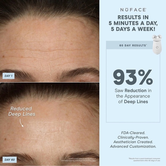 NuFace TRINITY+ - Picture 6 of 7